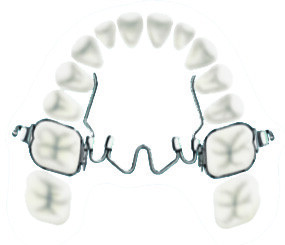Aparat Wewnątrzustny Expander 36mm